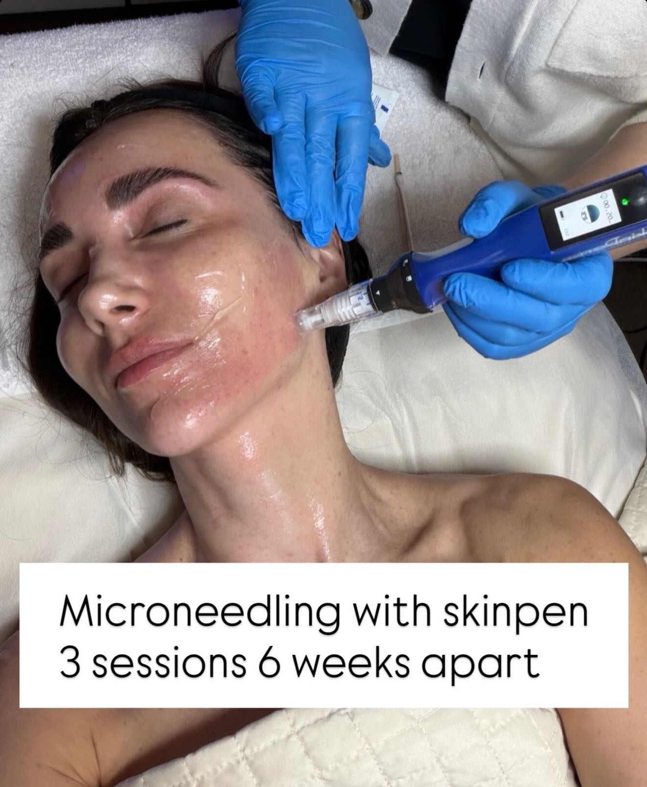 skincare in your 40s, skincare in your 50s, anti aging skincare, daily wellness habits, amazon finds, lip liner, full lips, teach whitening, weighted vest